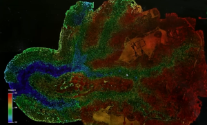 LiDAR scans reveal hidden Etruscan tombs beneath dense vegetation in central Italy.